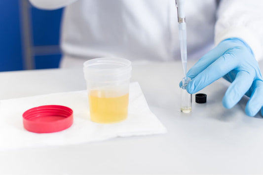 Un médecin analyse un échantillon d'urine