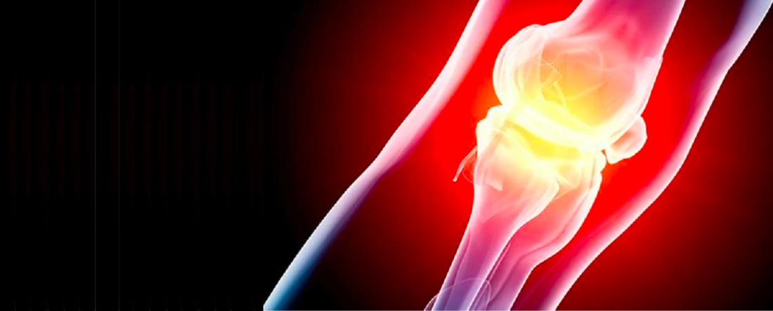 La fondation contre l’arthrite publie les premières directives pour les patients qui utilisent du CBD pour le soulagement de la douleur